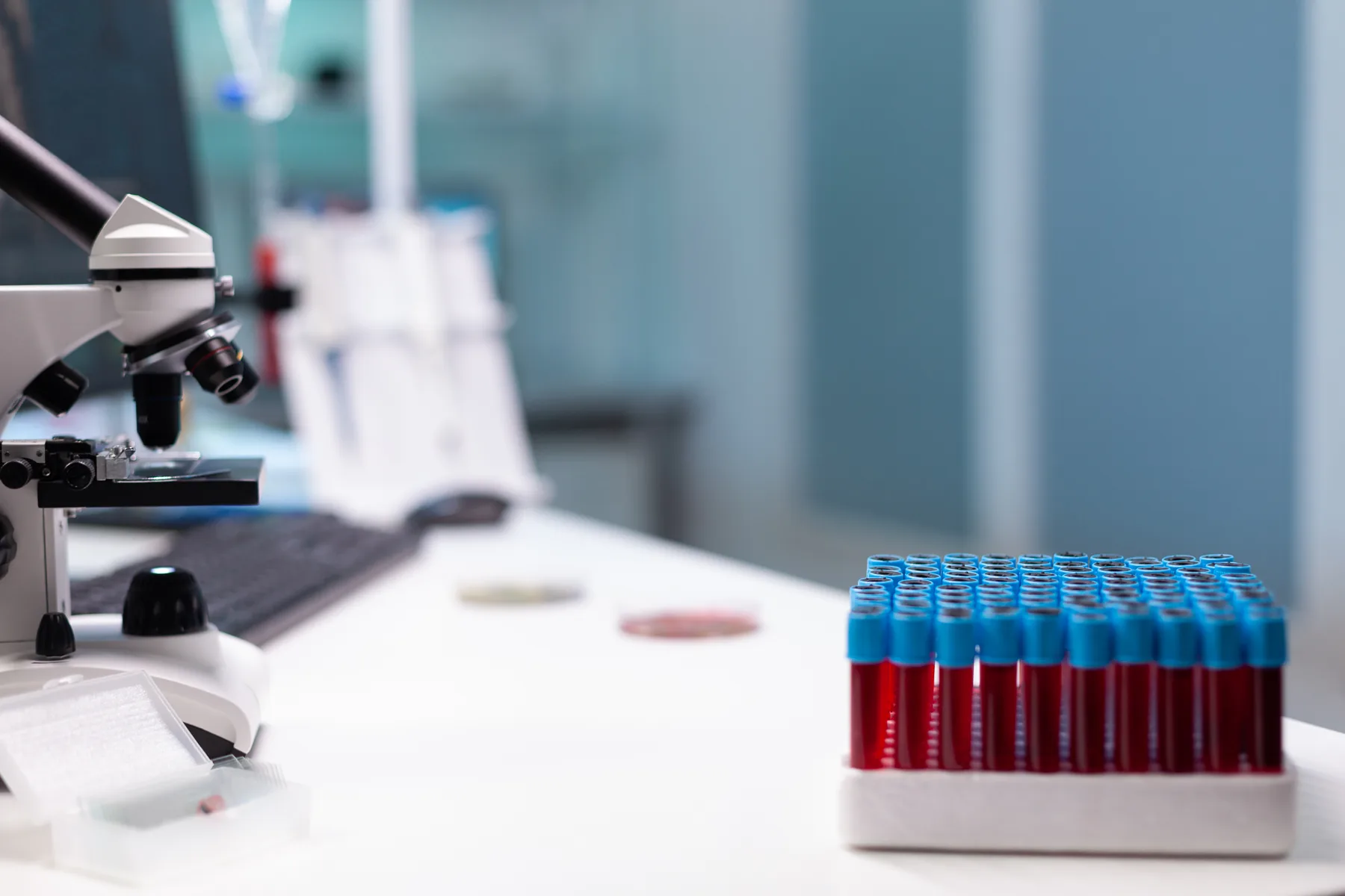 Microscópio e amostras para análises no laboratório do Hospital AmericanCor